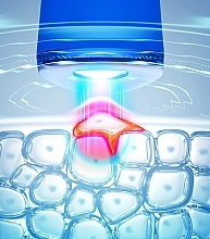 Urządzenie do leczenia trądziku z niebieskim światłem LED - Foreo Espada 2 Cobalt Blue — Zdjęcie N2