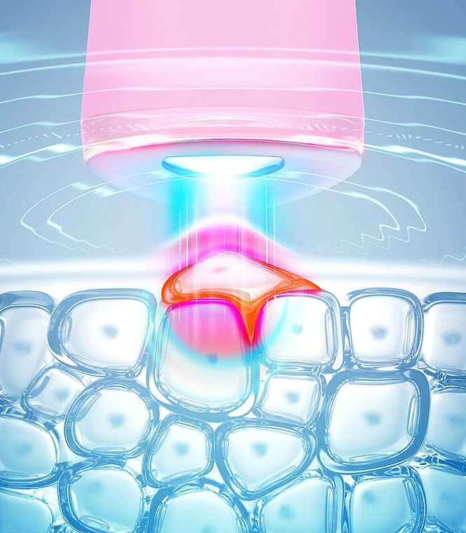 Urządzenie do leczenia trądziku z niebieskim światłem LED - Foreo Espada 2 Pearl Pink — Zdjęcie N2