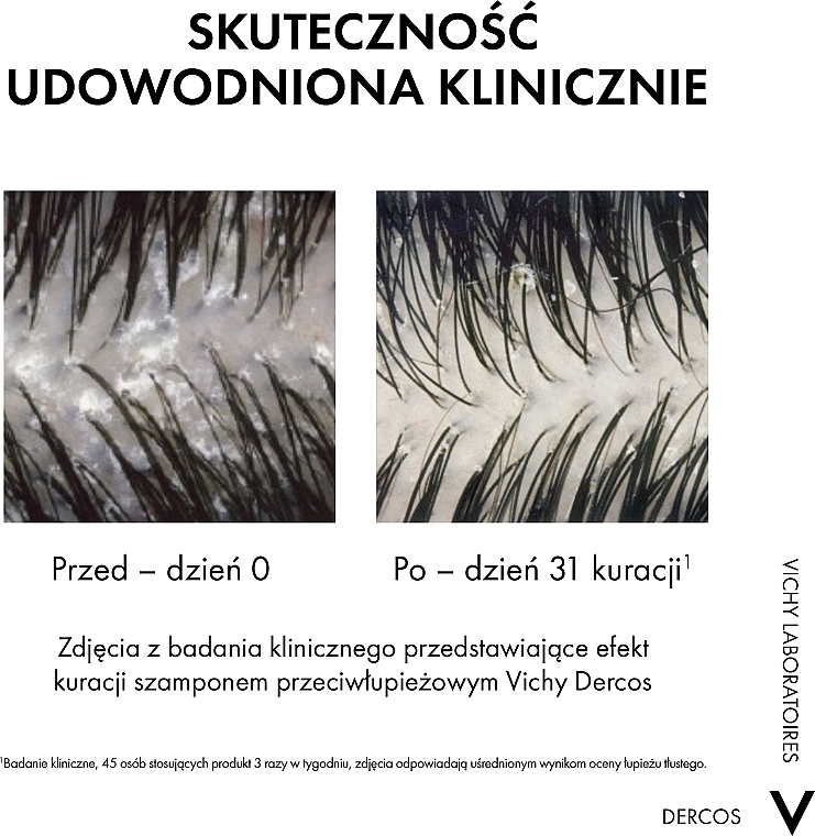 Odżywka dermatologiczna 2 w 1 przeciwłupieżowa do wszystkich rodzajów włosów i podrażnionej skóry głowy - Vichy Dercos 2in1 Shampoo — Zdjęcie N2