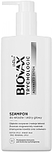 Trychologiczny szampon do włosów i skóry głowy - L'biotica Biovax Trychologic Advanced Detox Shampoo — Zdjęcie N1