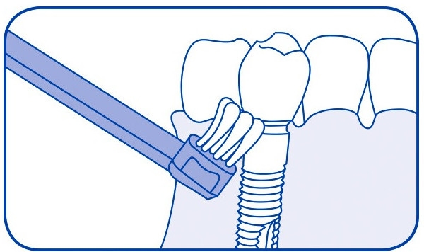 Jednopęczkowa szczoteczka do zębów Single CS 708, żółta - Curaprox CS 708 Implant — Zdjęcie N4