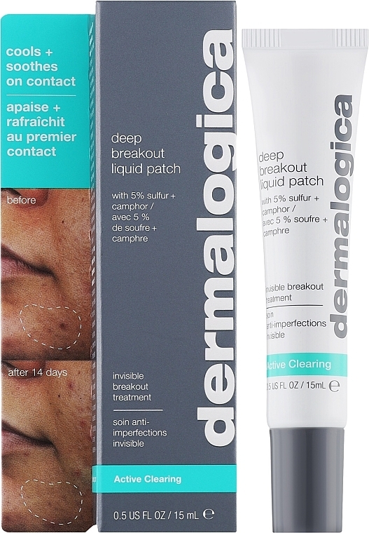 Plaster w płynie do leczenia trądziku - Dermalogica Deep Acne Invisible Liquid Patch — Zdjęcie N2