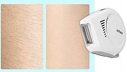 Depilator laserowy, biały - inFace Ipl Hair Removal Ii Zh-01F White — Zdjęcie N6