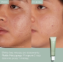 Matujący fluid do twarzy - Caudalie Vinopure Skin Perfecting Mattifying Fluid — Zdjęcie N10