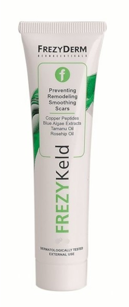 Delikatny krem na blizny - FrezyDerm FrezyKeld Scar Remodeling Cream — Zdjęcie N1