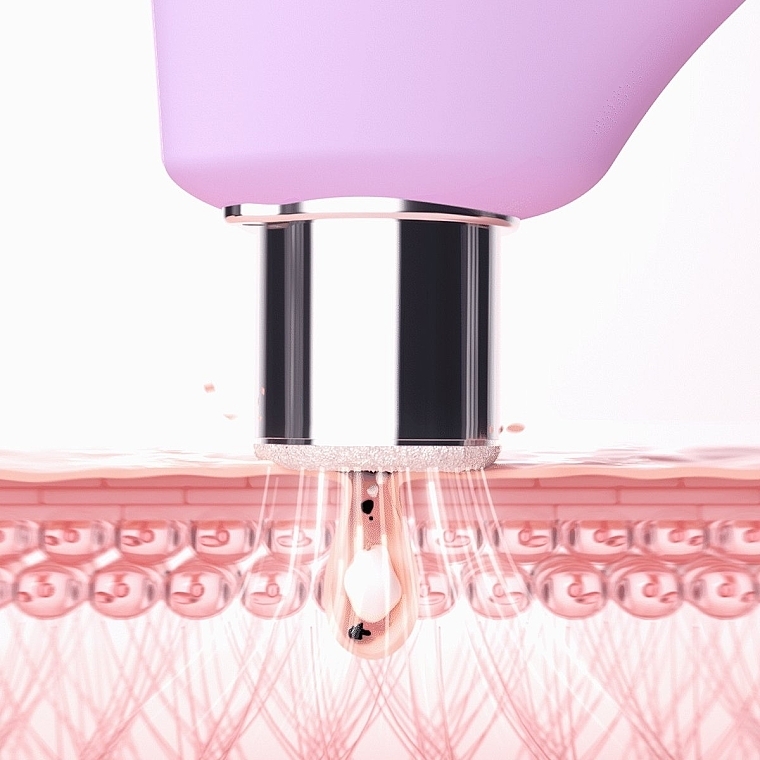 Urządzenie do mikrodermabrazji i oczyszczania porów - Foreo Kiwi Derma Diamond Microdermabrasion & Pore Vacuum Device — Zdjęcie N5