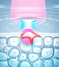 Urządzenie do leczenia trądziku z niebieskim światłem LED - Foreo Espada 2 Pearl Pink — Zdjęcie N2
