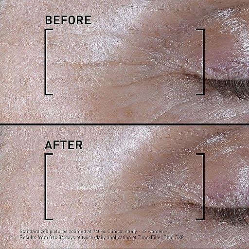 Intensywne serum do twarzy - Filorga Time-Filler Shot 5XP Concentrated Serum — Zdjęcie N8