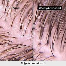 Głęboko oczyszczająca glinka do włosów - L'Oreal Professionnel Scalp Advanced Anti-Oiliness 2 In 1 Deep Purifier Clay — Zdjęcie N5