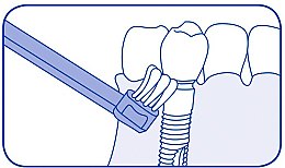 Jednopęczkowa szczoteczka do zębów Single CS 708, zielona - Curaprox CS 708 Implant — Zdjęcie N4