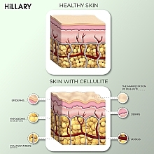 Okłady antycellulitowe na ciało z olejkiem ximenia - Hillary Anti-cellulite Bandage African Ximenia — Zdjęcie N5