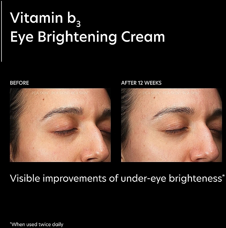 Rozjaśniający krem pod oczy - PCA Skin Vitamin B3 Eye Brightening Cream — Zdjęcie N3