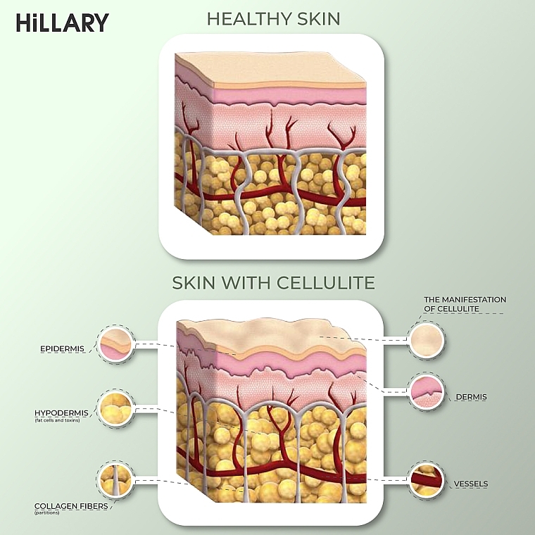 Okłady antycellulitowe na ciało z olejkiem ximenia - Hillary Anti-cellulite Bandage African Ximenia — Zdjęcie N5